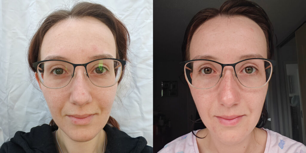Close-up comparison of a woman's face before and after skincare, wearing glasses, showing skin improvement. Lustre Renew Pro Facewear LED Light Therapy